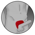Pierścień do elektrostymulacji - ElectraStim Silicone Fusion Viper ElectraStim