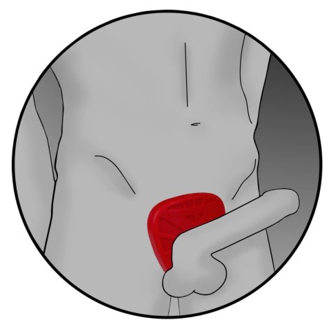 Pierścień do elektrostymulacji - ElectraStim Silicone Fusion Viper ElectraStim Pierścień do elektrostymulacji - ElectraStim Silicone Fusion Viper ElectraStim
